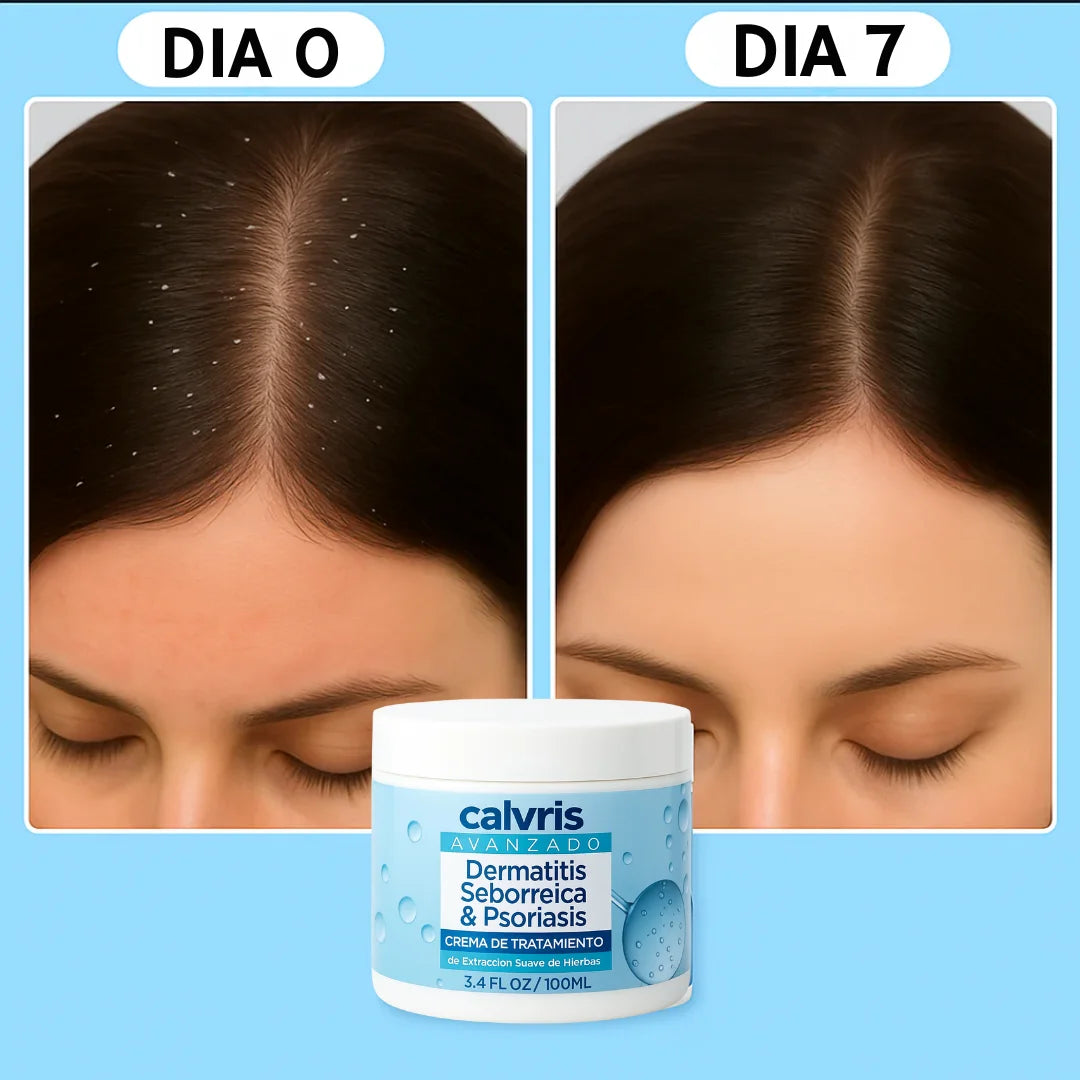 Calvris: bálsamo natural que alivia y calma tu piel